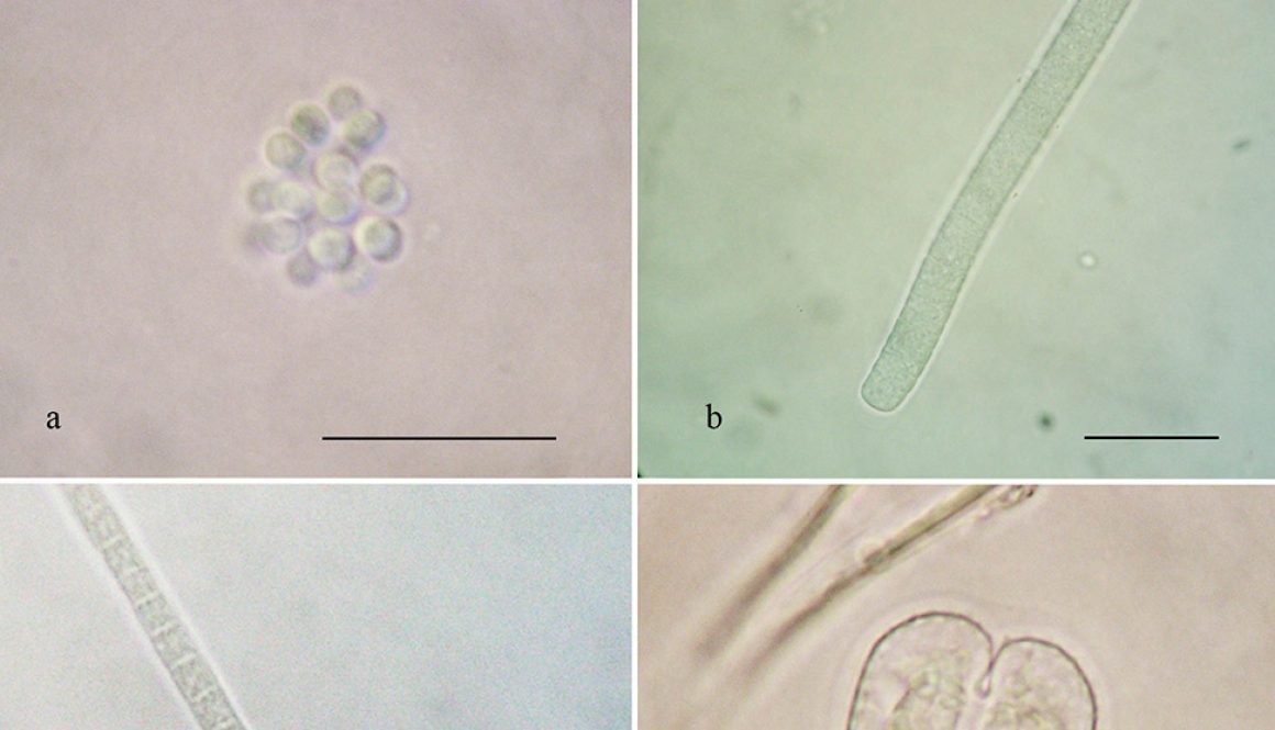 11des-ene-cianoprocariontes-microalgas